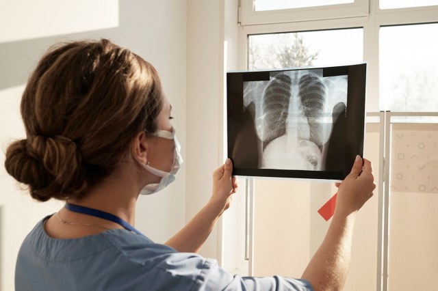 Doctor holding up an x-ray of a patient's chest